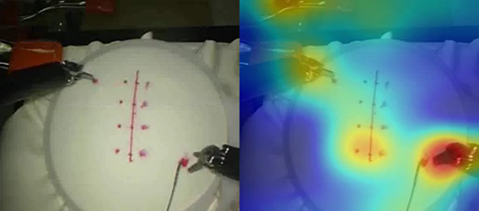 Image of simulated surgical scene alongside scene which has been analysed and colour coded.